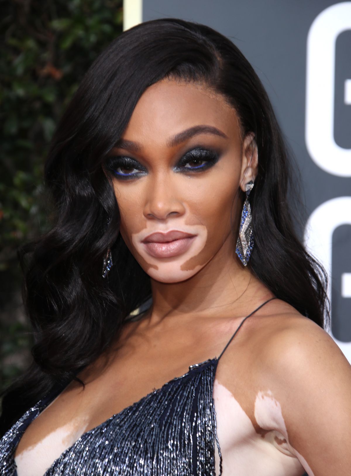 Winnie Harlow At 77th Annual Golden Globe Awards In Beverly Hills 0105